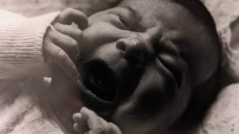 Neugeborenes mit weit geöffnetem Mund und zusammengezogener Stirn; weint bzw. schreit, Schwarzweiß.